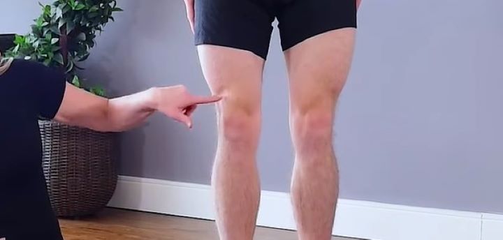 Analyzing how to pull off wearing shorts if you have fat knees